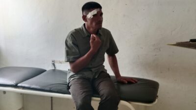 Gegara Bertanya Penebang Pohon Sawit Seorang Pria di Tassoko Dikeroyok Sama Tetangga Hingga Babak Belur