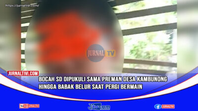 Bocah SD Dipukuli Sama Preman Desa Kambunong Hingga Babak Belur Saat Pergi Bermain